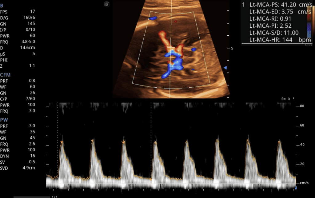 Perfil Hemodinámico