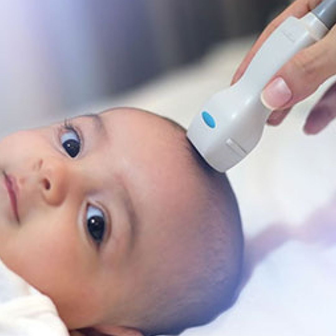 Sonografía Transfontanelar